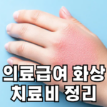 의료급여 화상 치료비