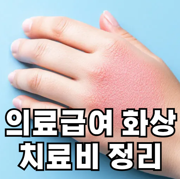 의료급여 화상 치료비